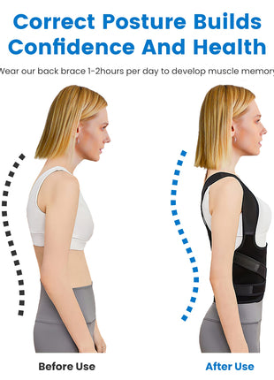 Adjustable Posture Corrector Back Brace for Women & Men – Upper Back Support