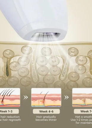 Professional IPL Laser Hair Removal Device – 900,000 Flashes Painless Epilator for Women & Men