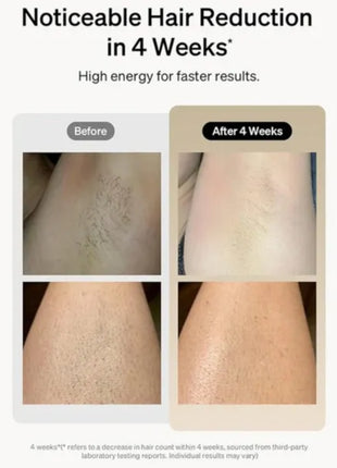 Professional IPL Laser Hair Removal Device – 900,000 Flashes Painless Epilator for Women & Men